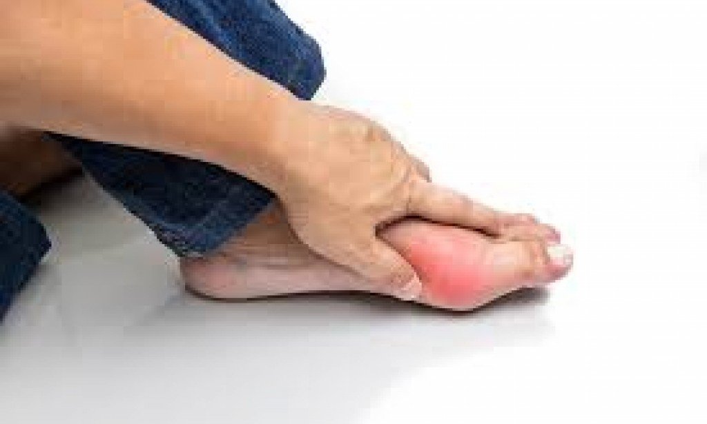 أعراض مرض النقرس وطرق علاجه