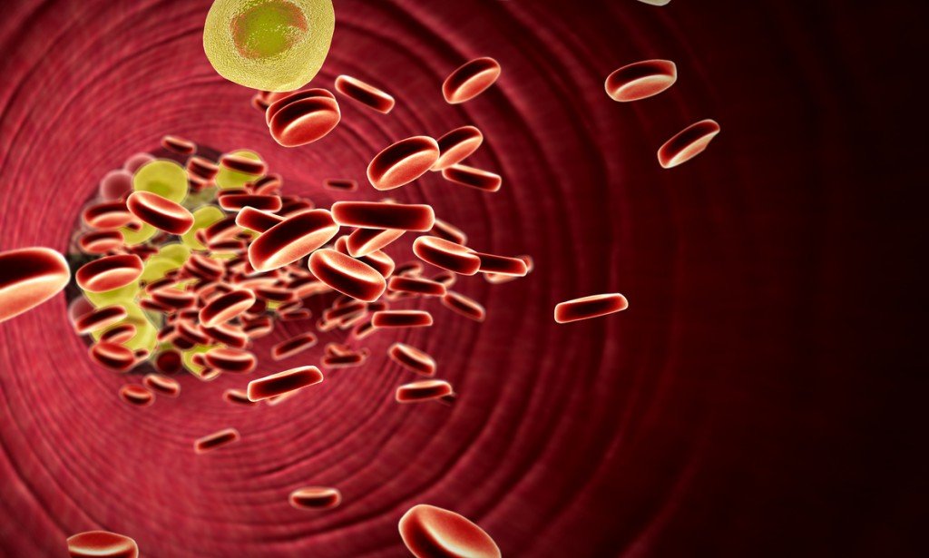 ارتفاع الكوليسترول في الدم Hypercholesterolemia