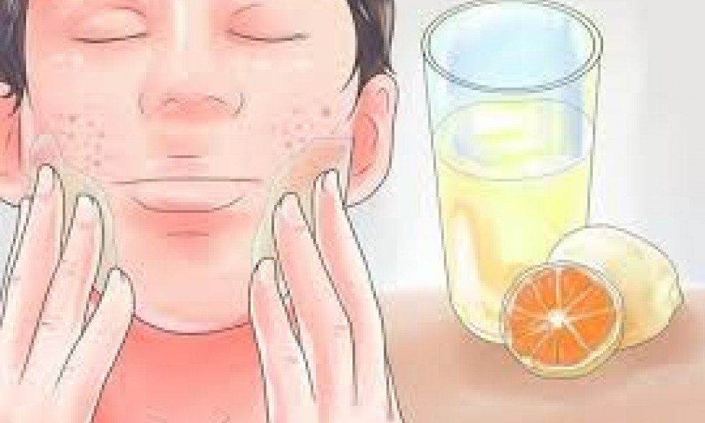 أفضل الوصفات والأدوية التي تعالج حب الشباب وتزيل آثاره