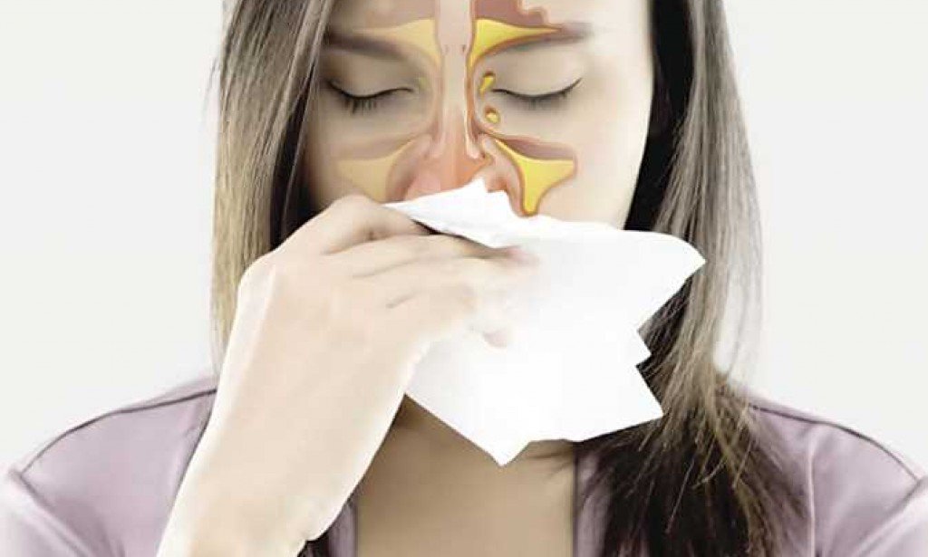 أقوي مسكن للجيوب الأنفية