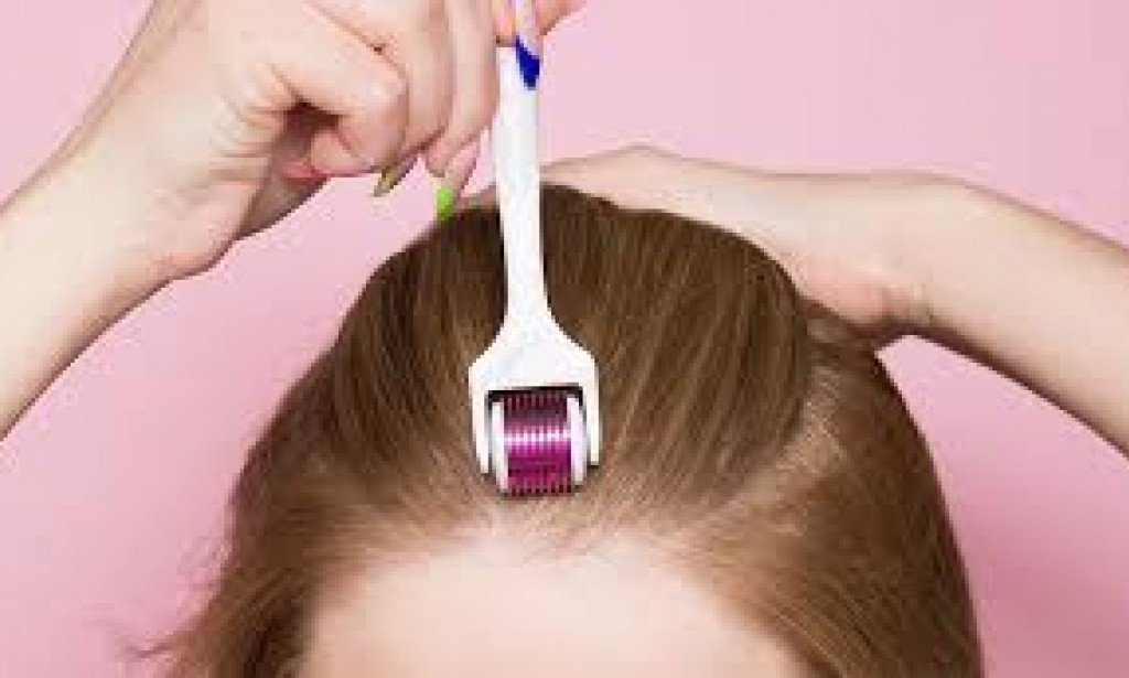 الديرما رولر لإنبات الشعر وعلاج الصلع