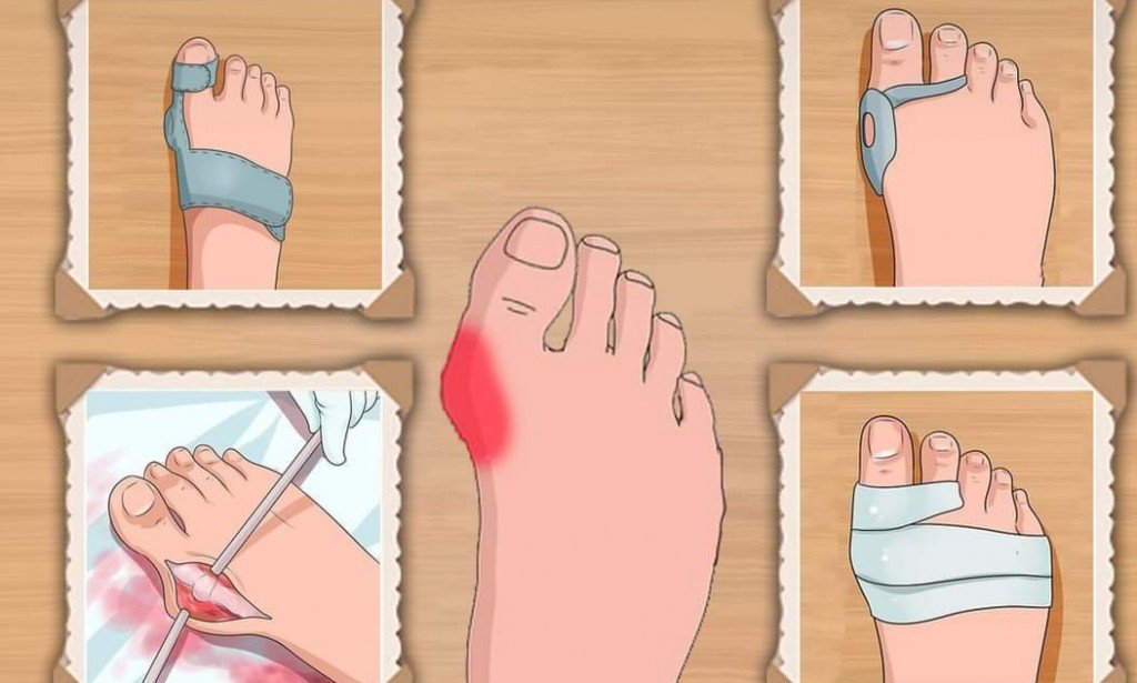 الوكعة تنتشر عند النساء  اليكم اسبابها ؟ وأعراضها وعلاجها