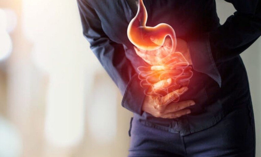 ارتجاع المرئ وقرحة المعدة