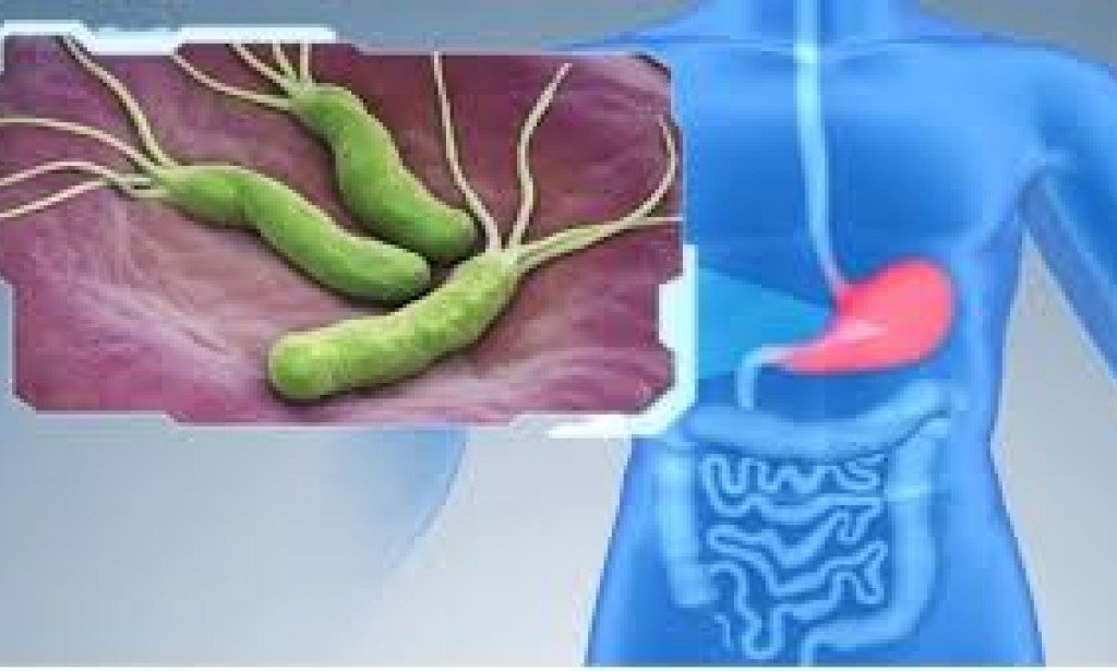 ما لا تعرفه عن جرثومة المعدة !!!!