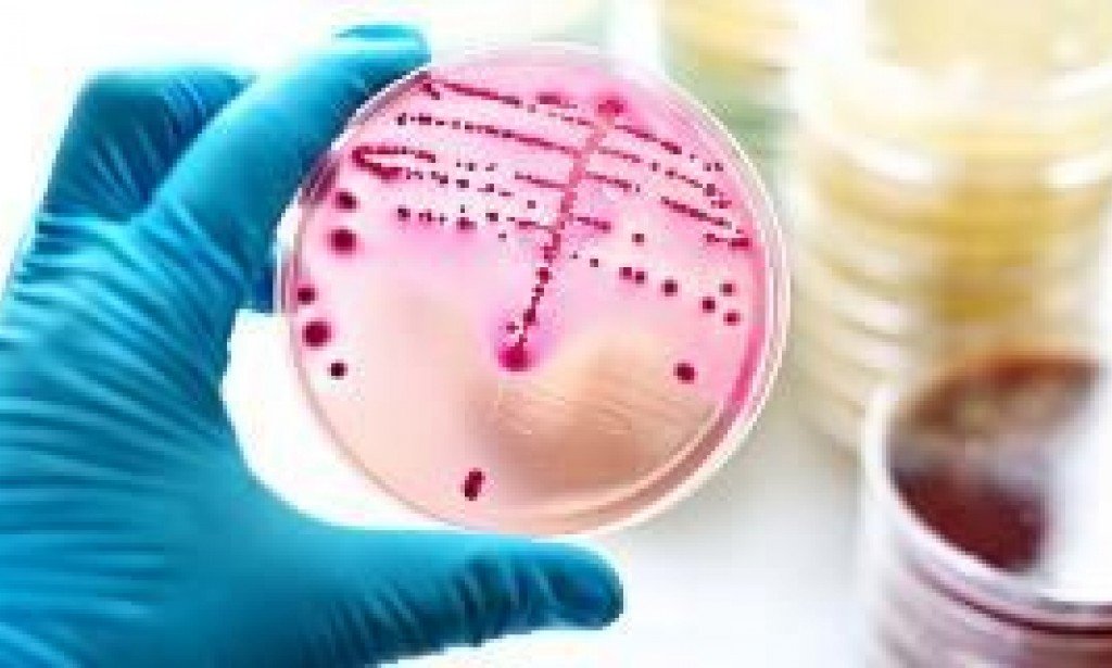 الميكروب السبحى