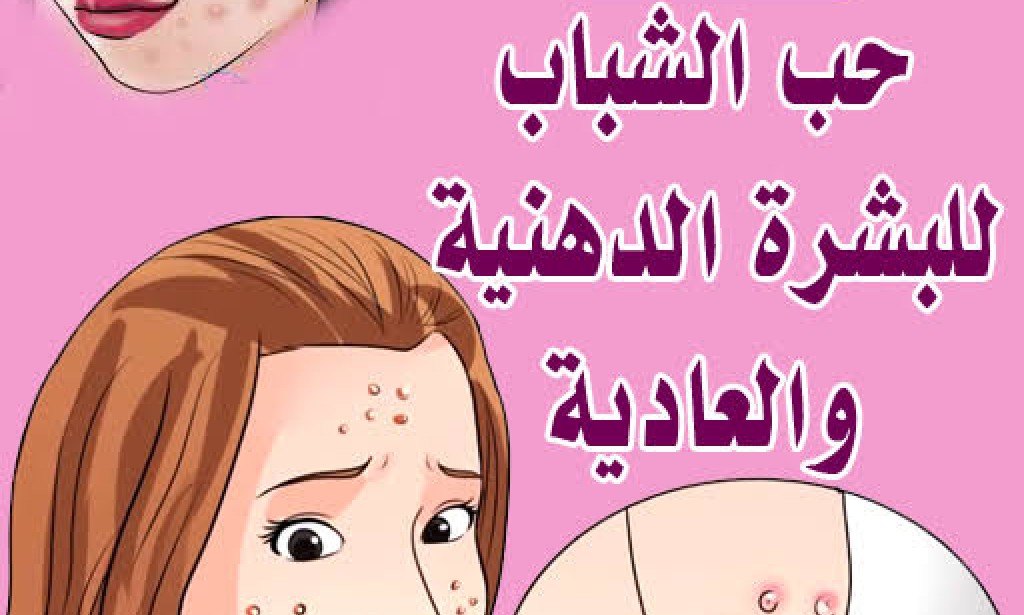 علاج حب الشباب للبشرة الدهنية