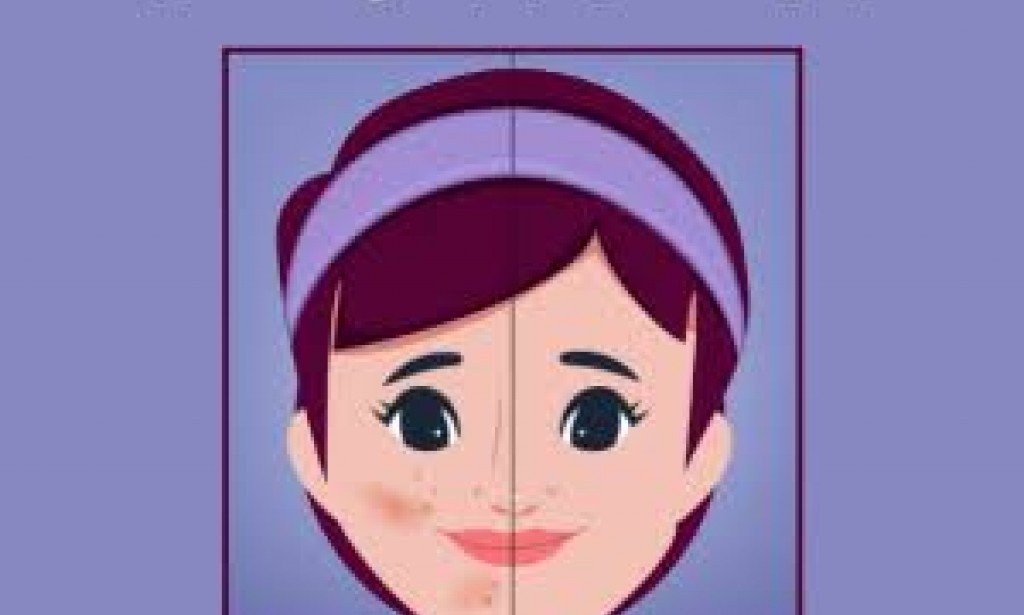 كيفيه الاعتناء بالبشرة الدهنية