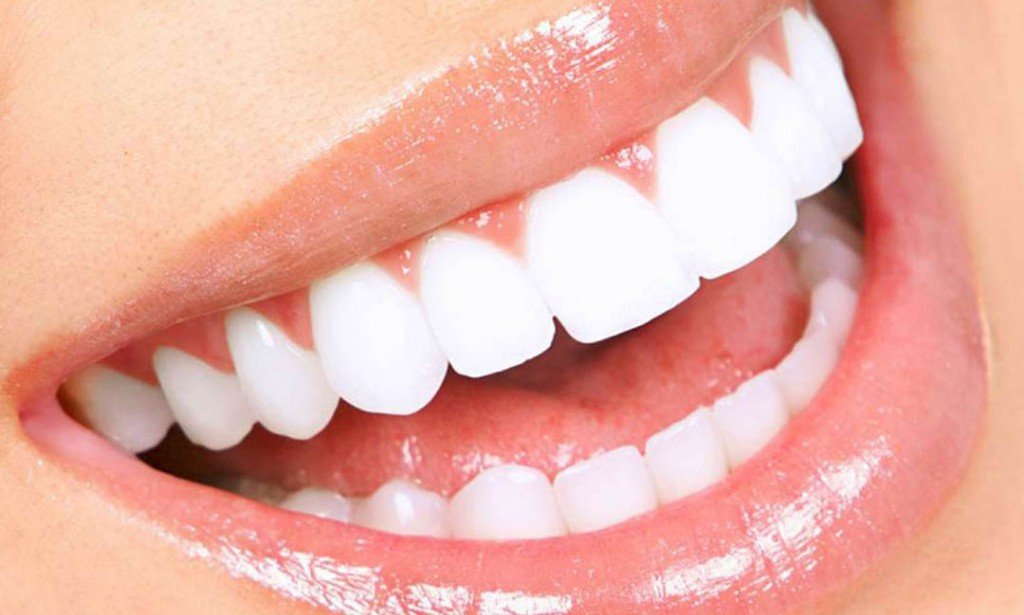 هوليود سمايل - اتعلميها بالتفصيل