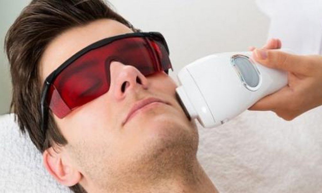 أضرار إزالة الشعر بالليزر