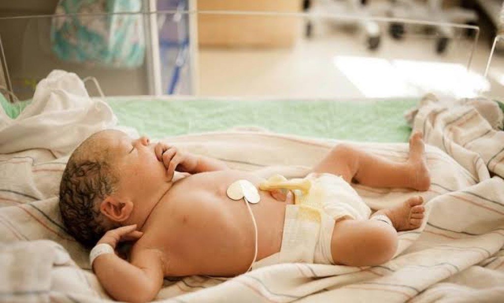 تشوهات القلب عند الأطفال حديثي الولادة