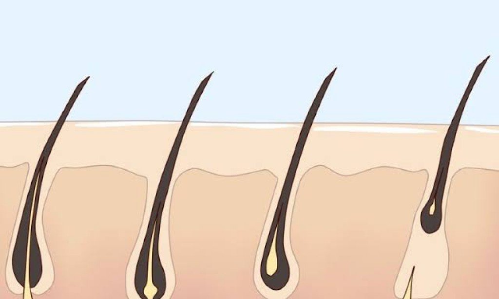 خلل الهرمونات من أسباب نمو الشعر الزائد بسرعة عند المرأة