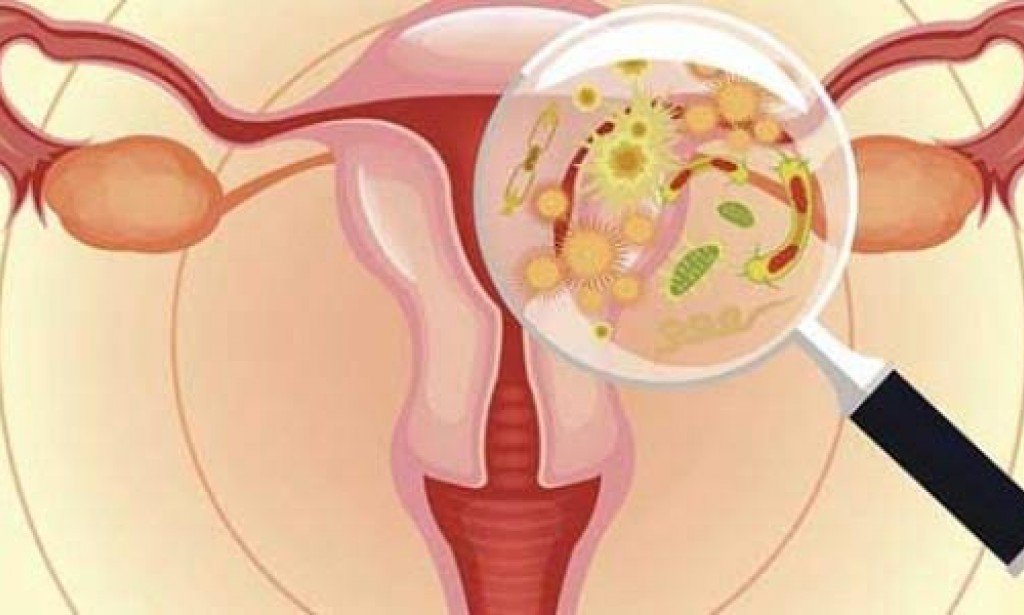 التهابات المهبل الفطرية أسبابها وطرق علاجها والوقاية منها