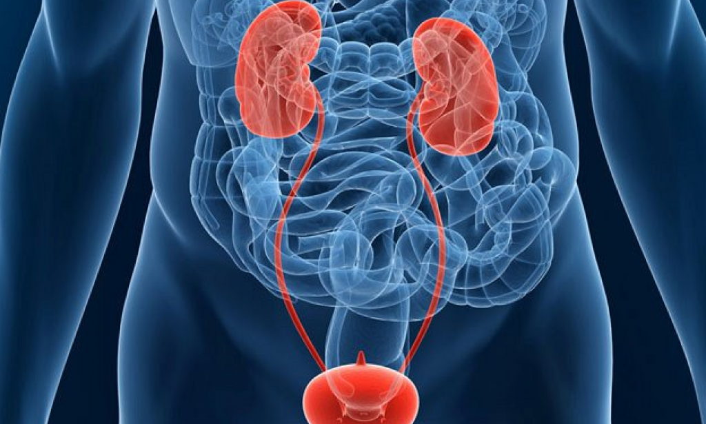 تجربتي مع سرطان المثانة