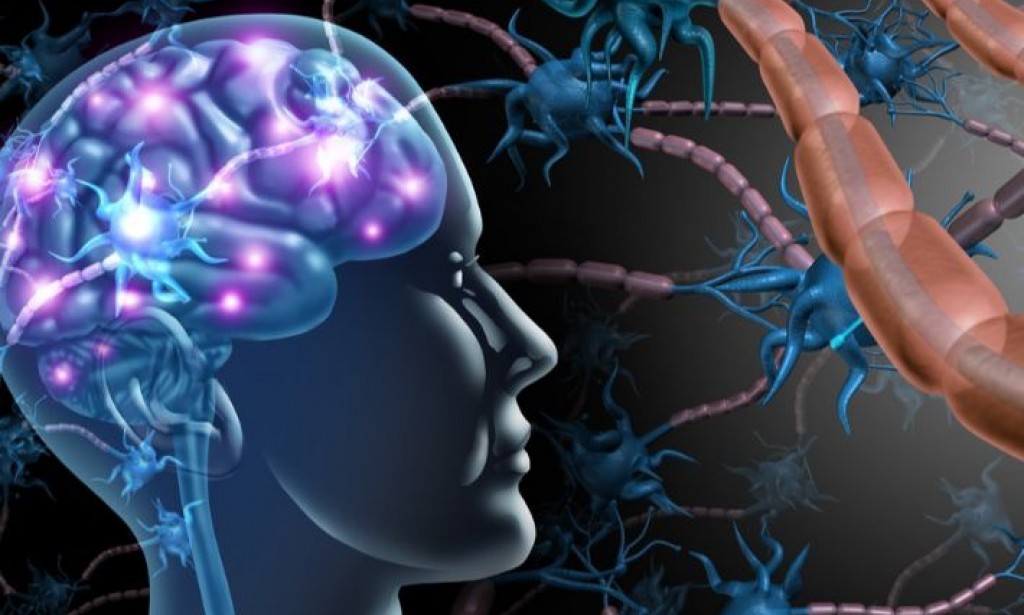 ماذا تعرف عن مرض التصلب اللويحي ؟  What do you know about multiple sclerosis