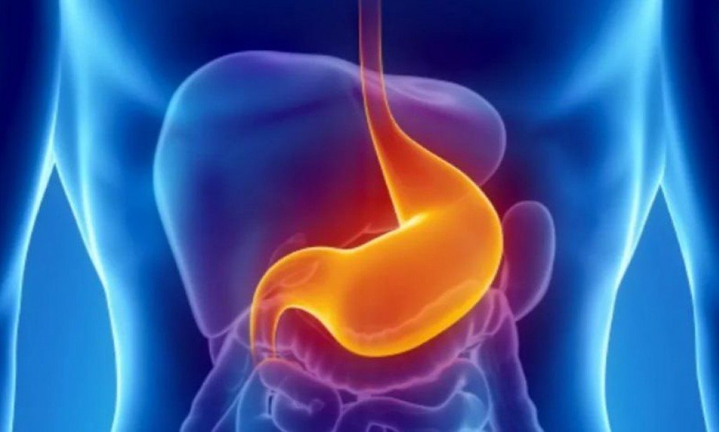 قرحة المعدة..أسبابها وأعراضها وتشخيصها و 4 طرق لعلاجها