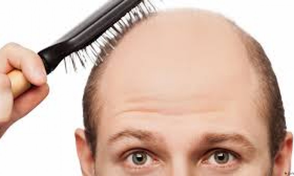 نصائح فعّالة للحفاظ على صحة الشعر ومنع تساقطه