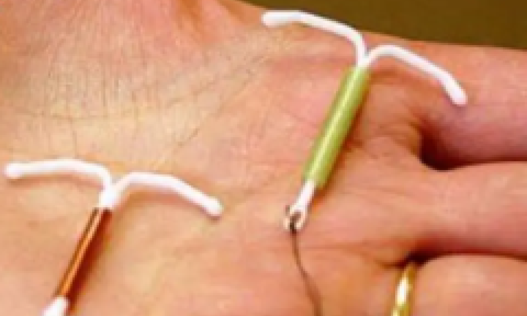 اللّولب النحاسي أم اللّولب الهرموني؟ مقارنة طبية تفصيلية 2026